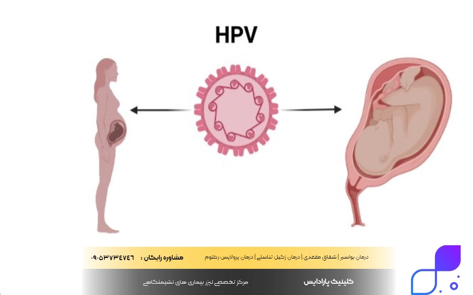 شایع ترین راه انتقال زگیل تناسلی (HPV)