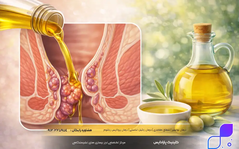 روغن زیتون برای بواسیر خوب است