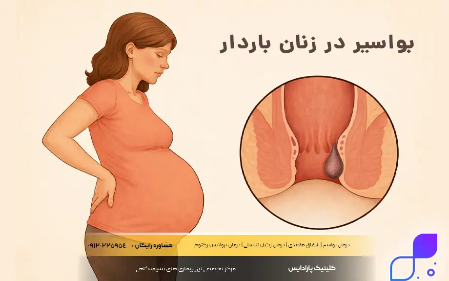 بواسیر در زنان باردار