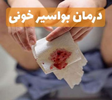 درمان بواسیر خونی
