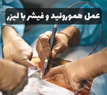 عمل هموروئید و فیشر با لیزر