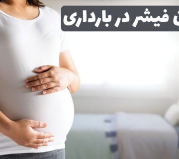 درمان فیشر در بارداری