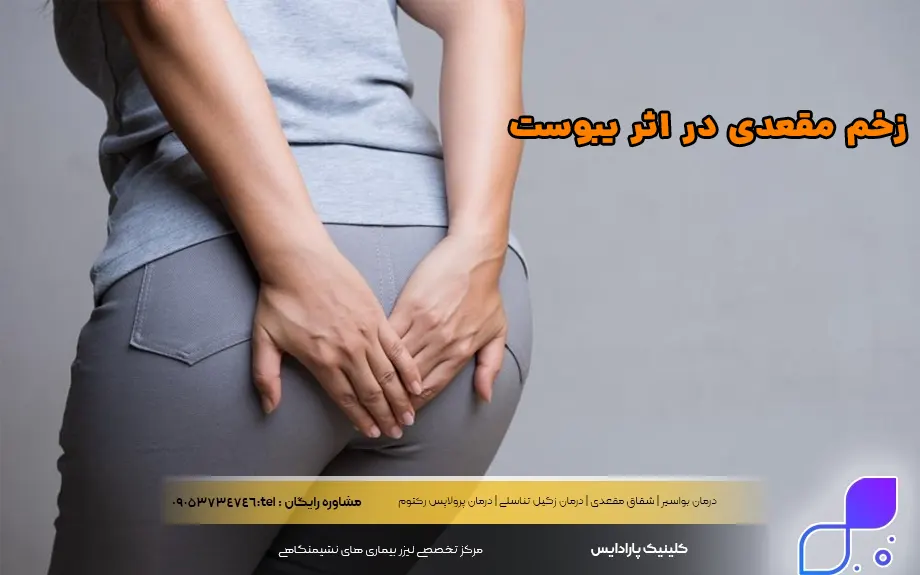 زخم مقعدی در اثر یبوست