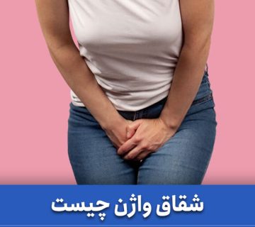 شقاق واژن چیست
