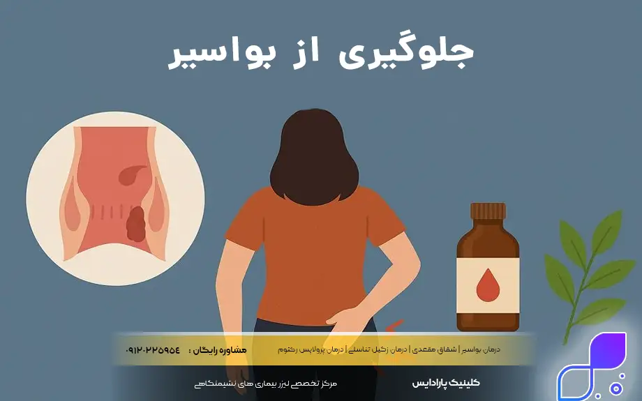 جلوگیری از بواسیر