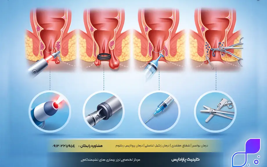 بواسیر در مردان چگونه درمان میشود
