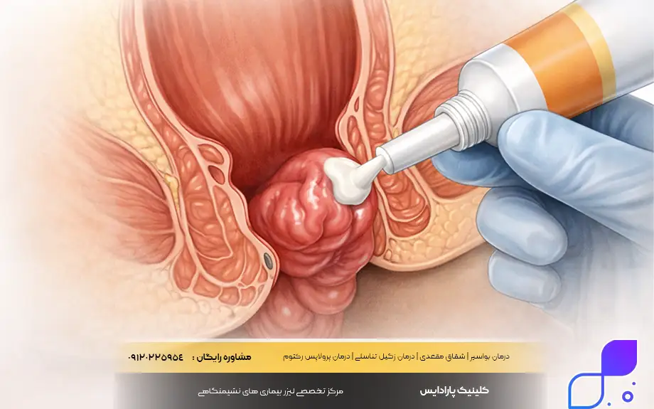 پماد برای درمان پرولاپس رکتوم