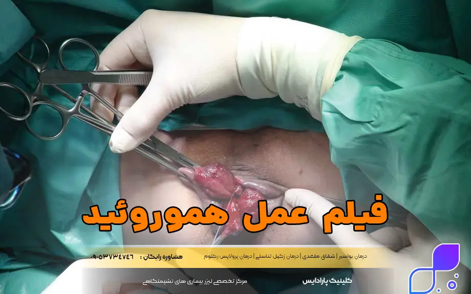 فیلم عمل هموروئید