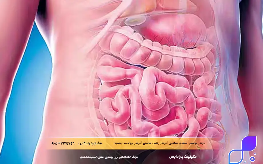 انسداد روده در سالمندان
