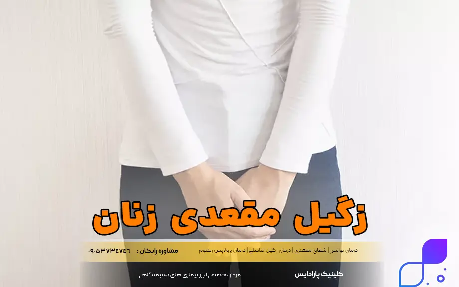 زگیل مقعدی در زنان