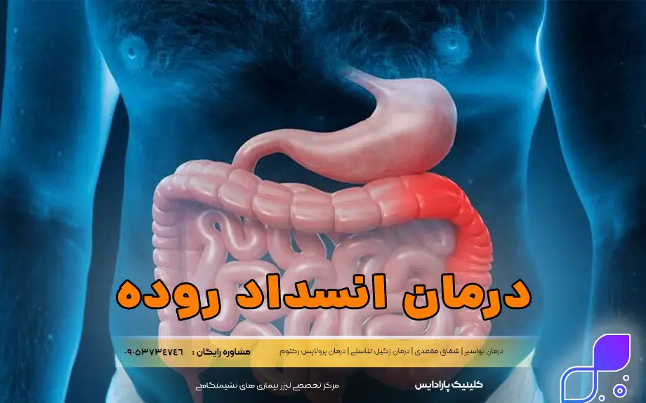درمان انسداد روده
