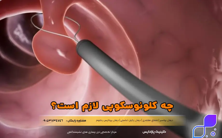 چه کلونوسکوپی لازم است؟