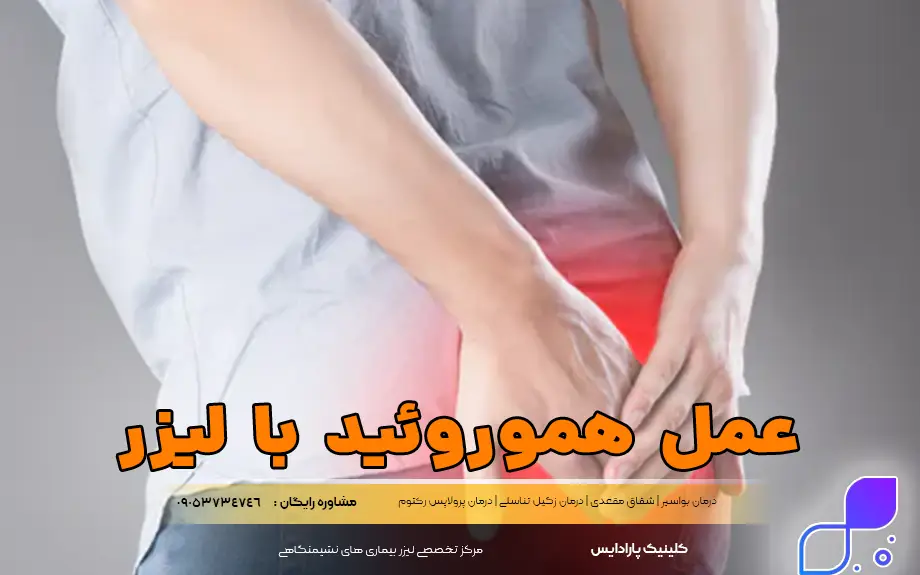 عمل بواسیر با لیزر