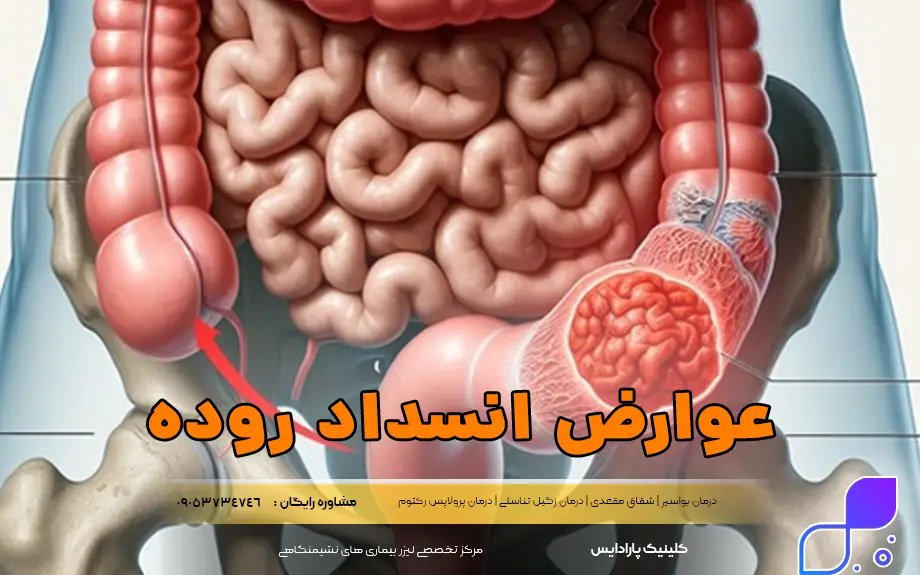 عوارض انسداد روده