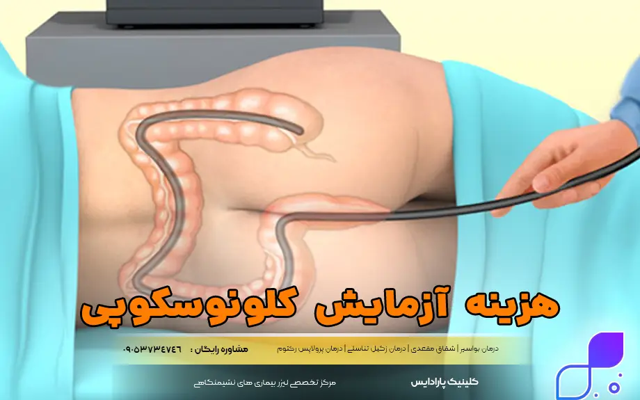 هزینه آزمایش کلونوسکوپی