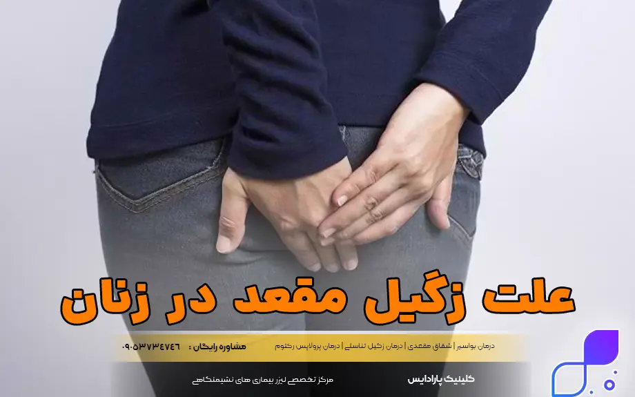 علائم زگیل مقعدی در زنان