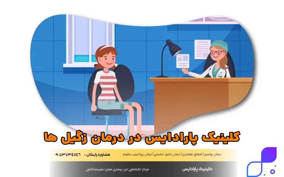درمان انواع زگیل مقعدی