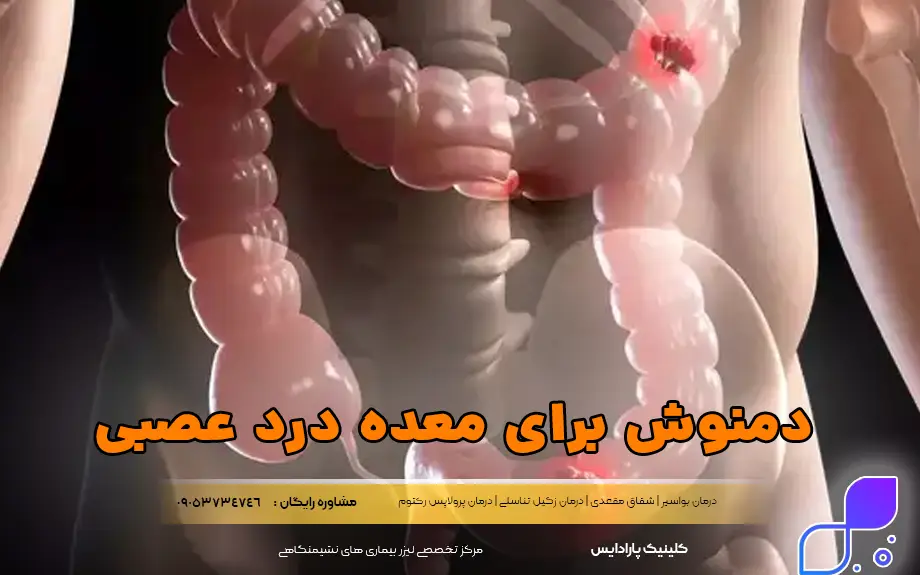 بهترین دم نوش ها برای معده درد عصبی