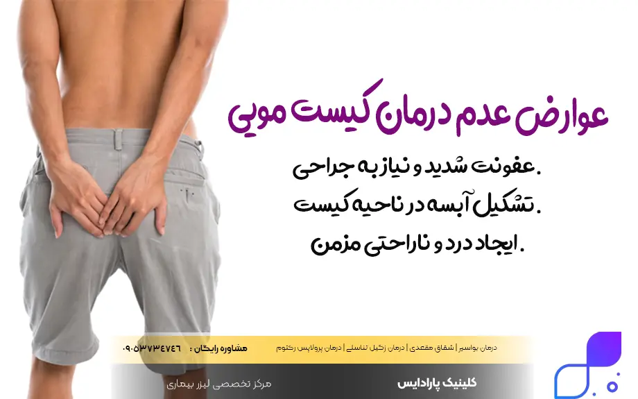 بهترین درمان های کیست مویی