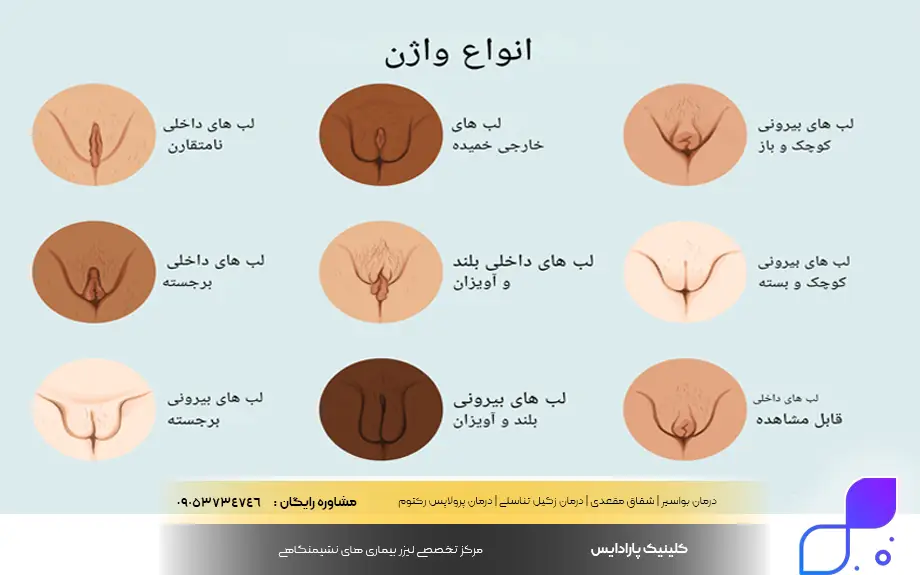 آناتومی واژن + واژن زن چند سوراخ دارد؟