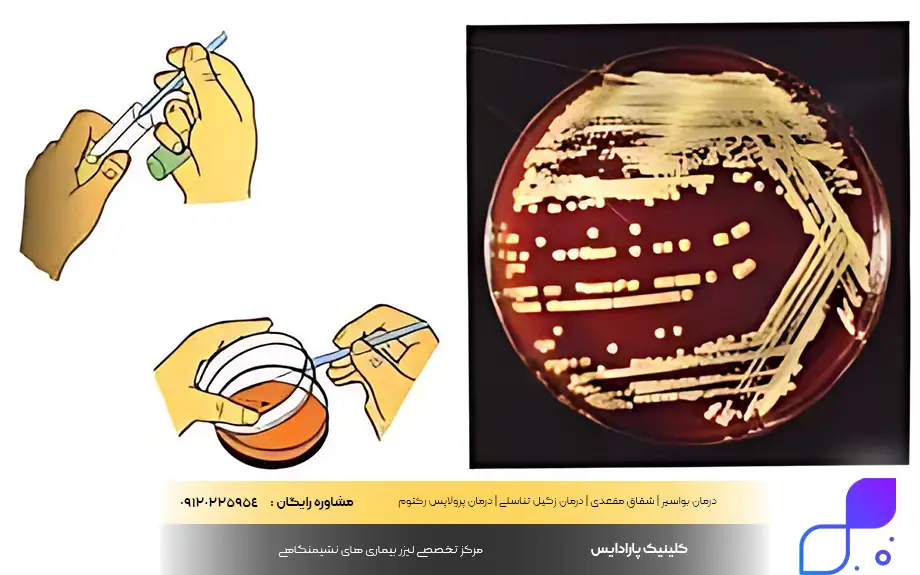 آزمایشات بعد از درمان سوزاک