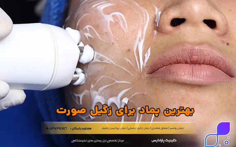 بهترین پماد برای زگیل صورت