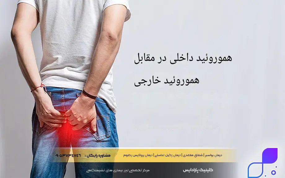 تفاوت هموروئید داخلی و خارجی