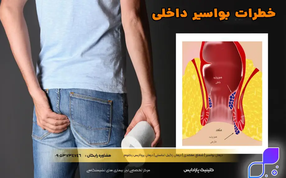 خطرات بواسیر داخلی
