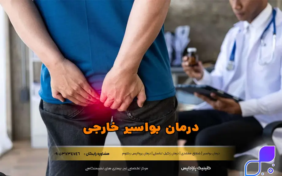 درمان بواسیر خارجی