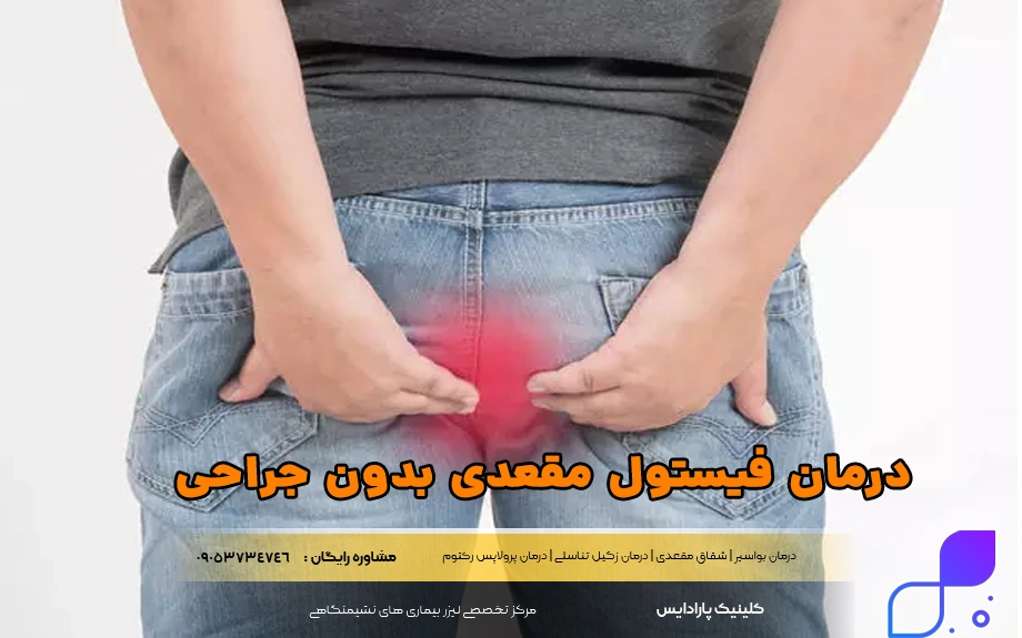 درمان فیستول مقعدی بدون جراحی