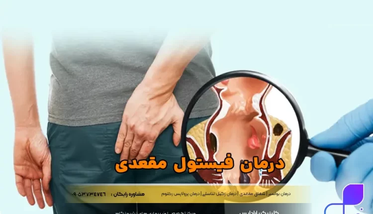 درمان فیستول مقعدی