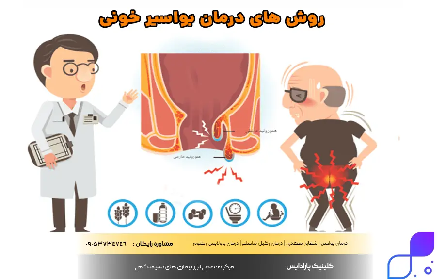 روش های درمان بواسیر خونی