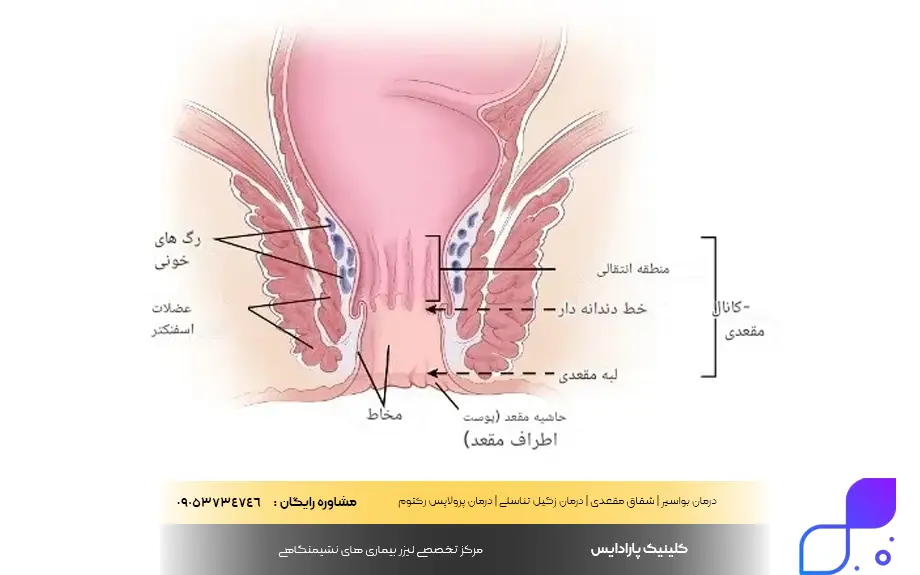 ساختار مقعد