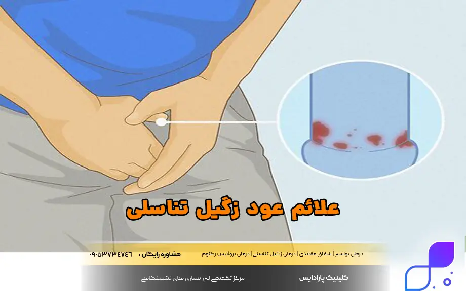 علائم عود مجدد زگیل تناسلی