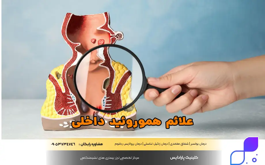 علائم هموروئید داخلی