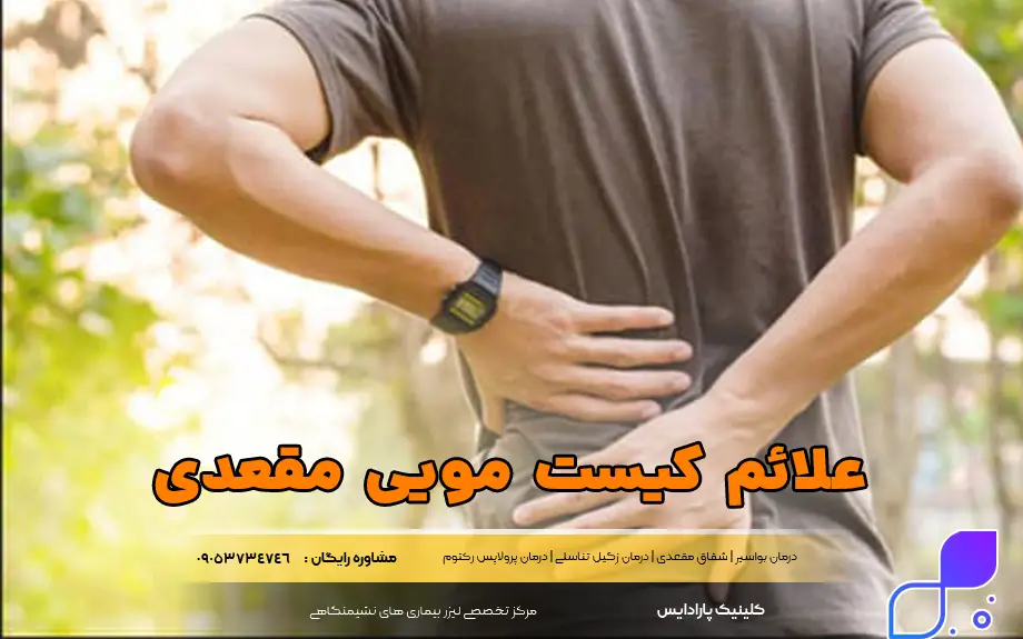 علائم کیست مویی مقعدی