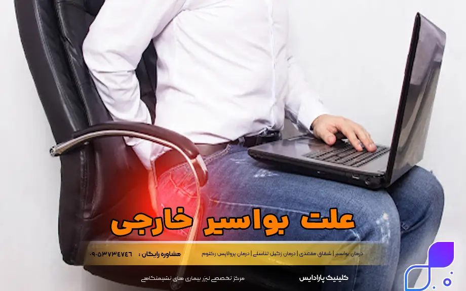 علت بواسیر خارجی