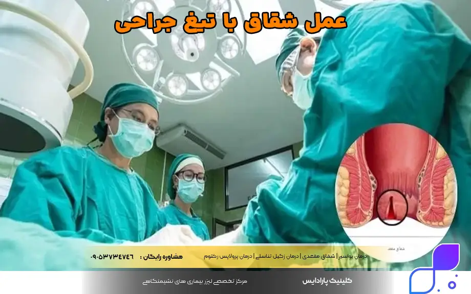 عمل شقاق با تیغ جراحی