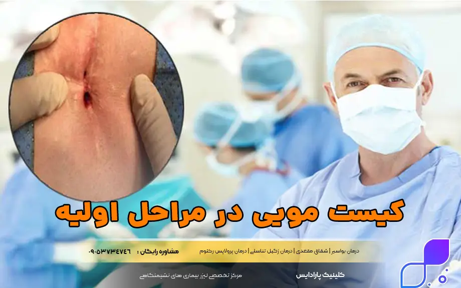 عکس کیست مویی در مراحل اولیه