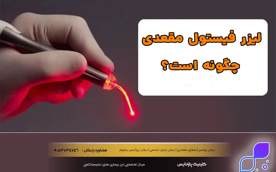 لیزر فیستول مقعدی چگونه است؟