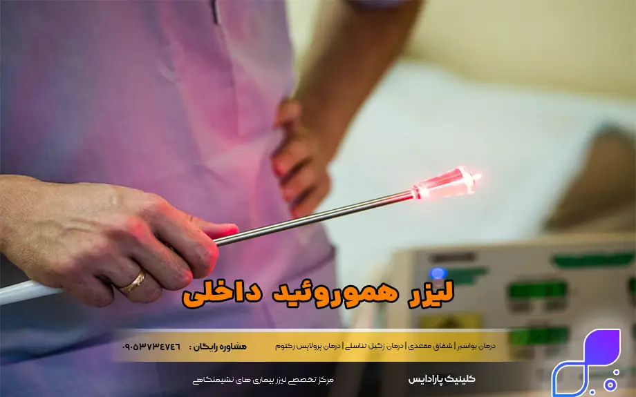 لیزر هموروئید داخلی