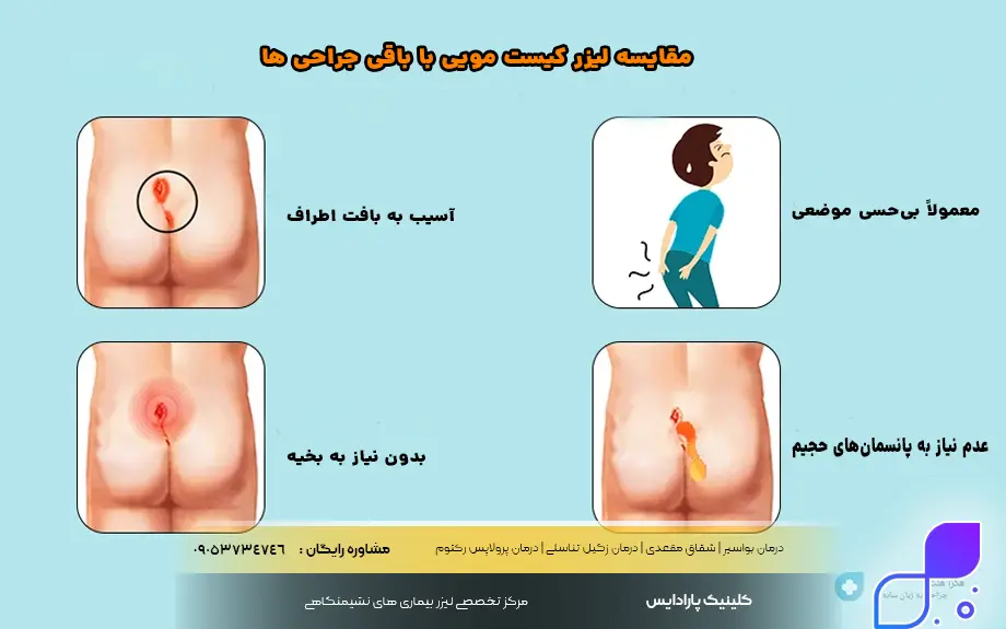 مقایسه لیزر کیست مویی با باقی جراحی ها