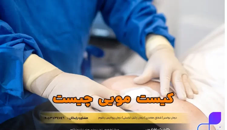 کیست مویی چیست