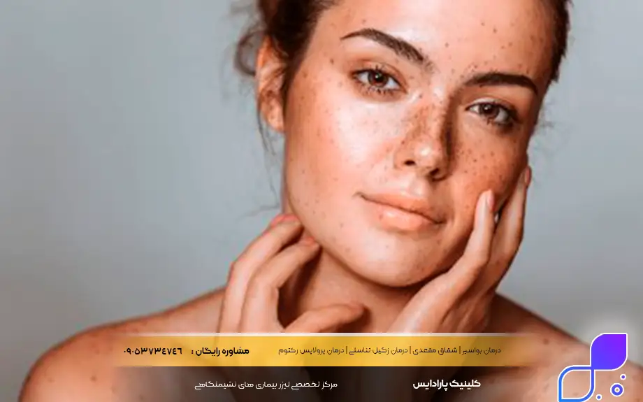 پماد بتامتازون برای لک صورت