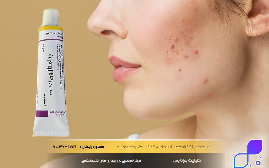 پماد بتامتازون برای جوش صورت