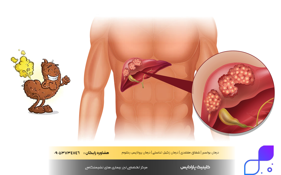 علت بوی بد مدفوع چیست؟