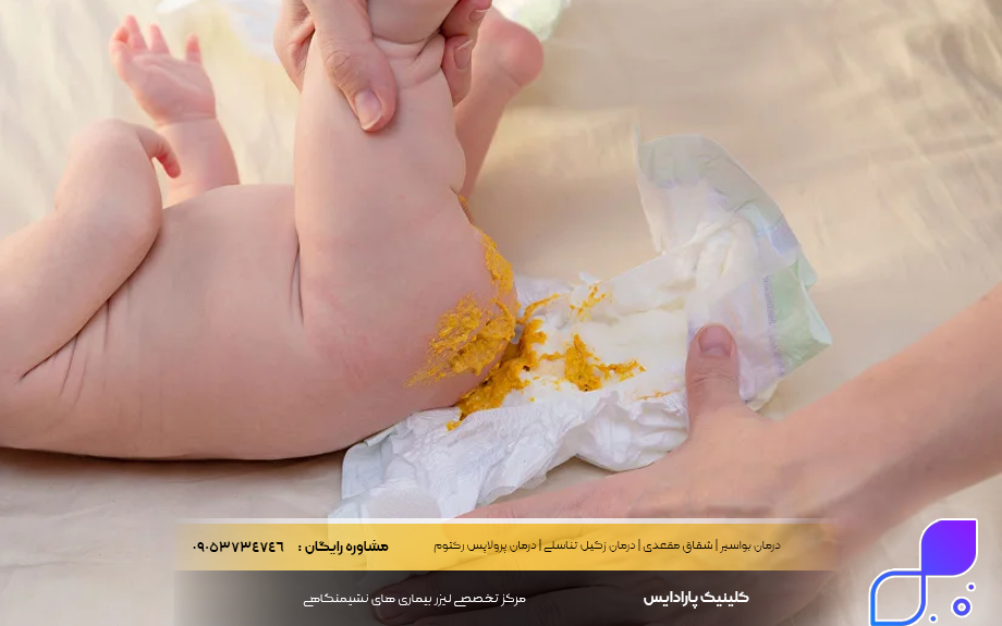 بوی بد مدفوع نوزاد