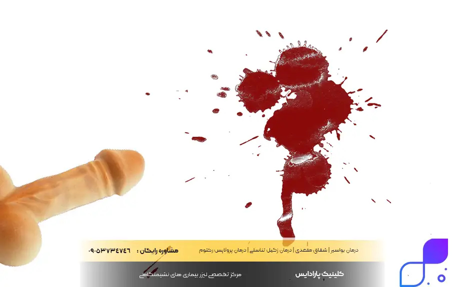 درمان خون در ادرار اقایان