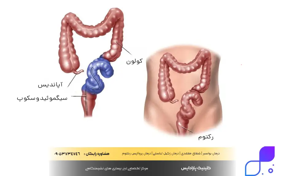 آمادگی های قبل از آزمایش سیگموئیدوسکوپی