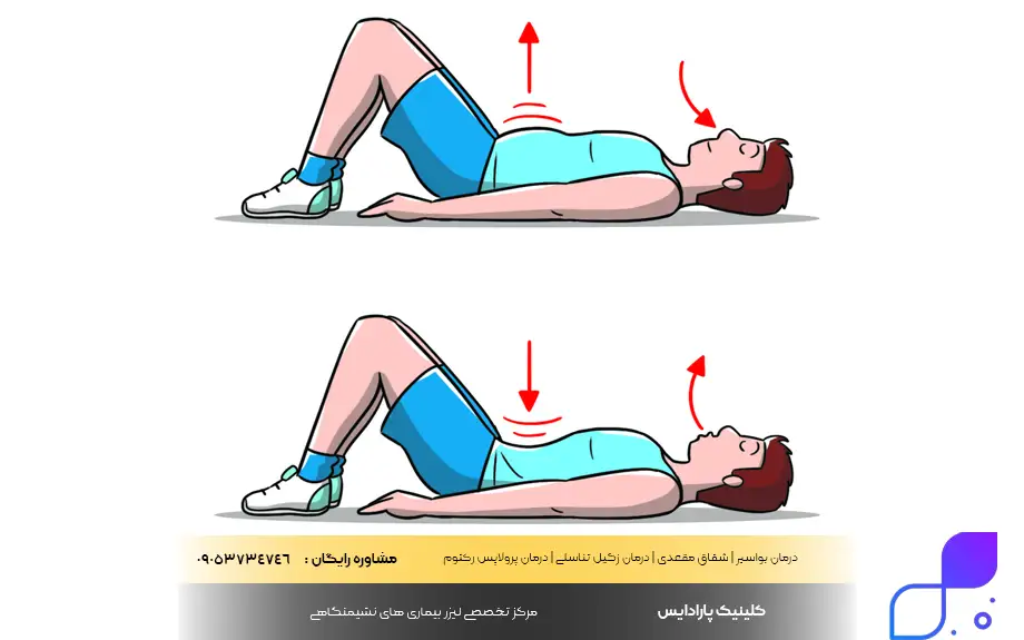 درمان خانگی اسپاسم مقعدی